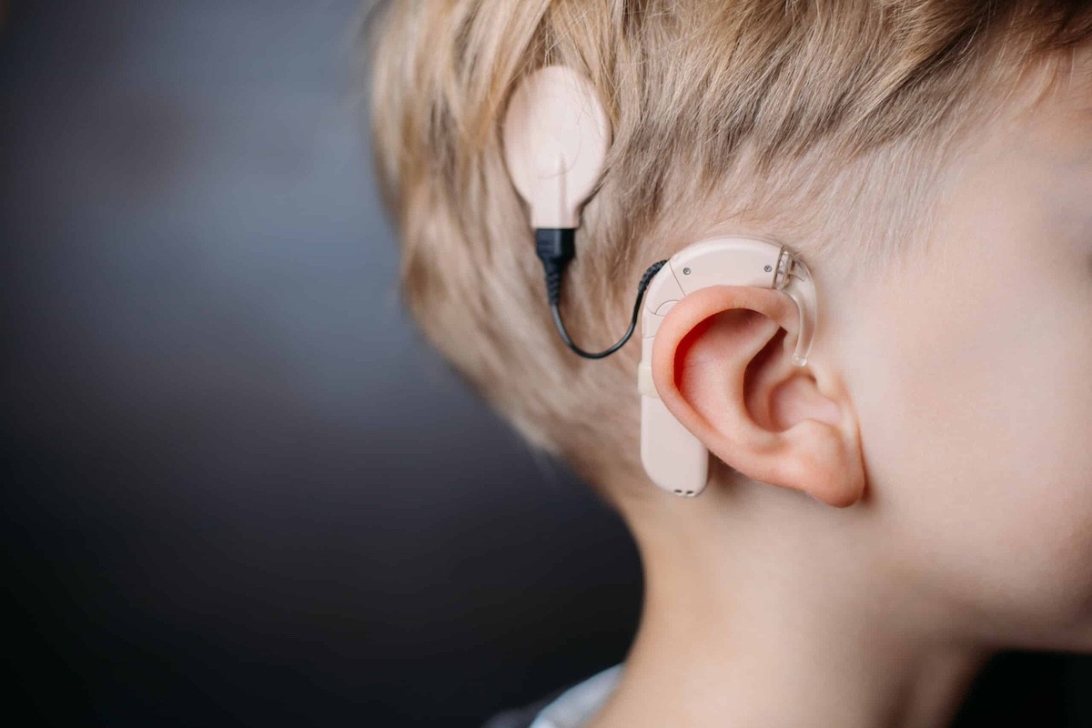 Cochlear implants R&D preview article image